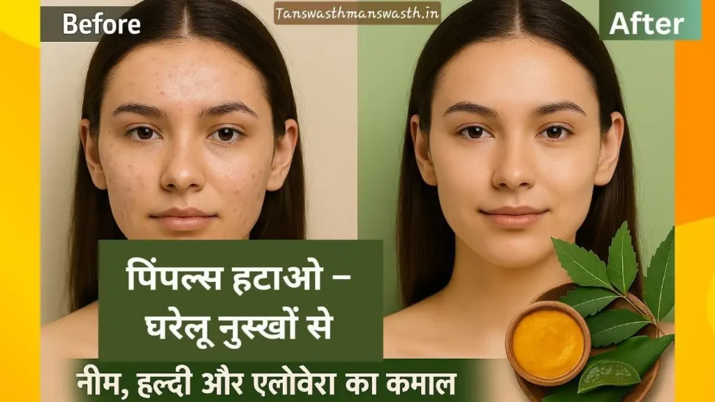 पहले और बाद की तुलना, लड़की के चेहरे पर पिंपल्स हटाने के लिए नीम, हल्दी और एलोवेरा घरेलू नुस्खे हिंदी में