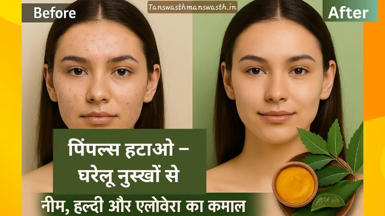 पिम्पल्स कैसे हटाएं ? जानिए कारण,घरेलू उपाय और बचाव के तरीके