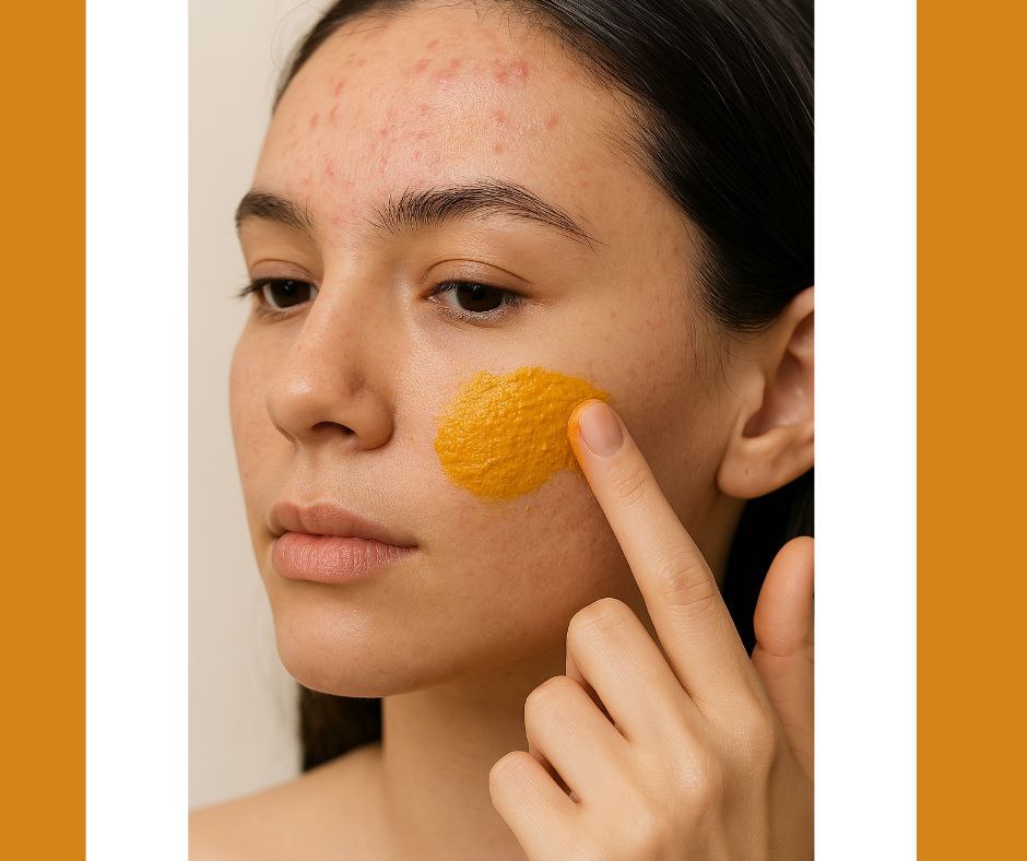 पिम्पल्स कैसे हटाएं