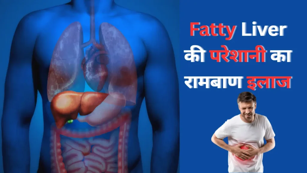 Fatty Liver के कारण और घरेलू उपाय
