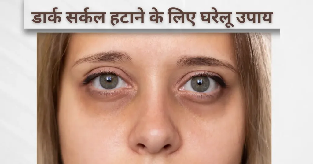 dark circle हटाने के घरेलू उपाय – आंखों के नीचे काले घेरे कम करने के लिए नैचुरल टिप्स