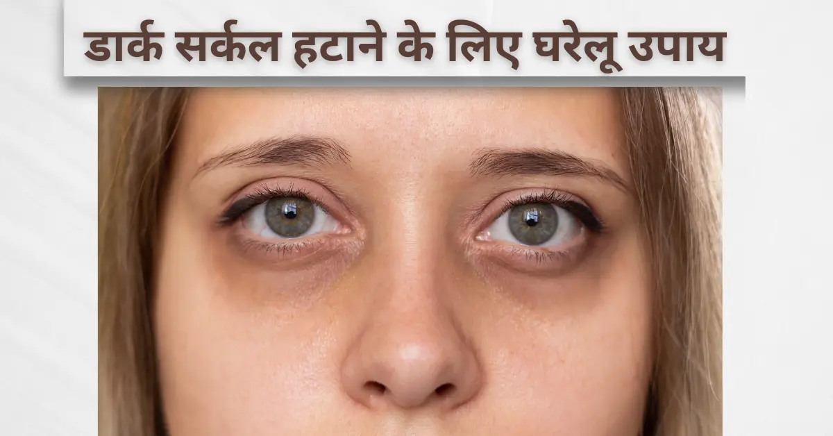डार्क सर्कल हटाने के लिए घरेलू उपाय जो सच में काम करते हैं