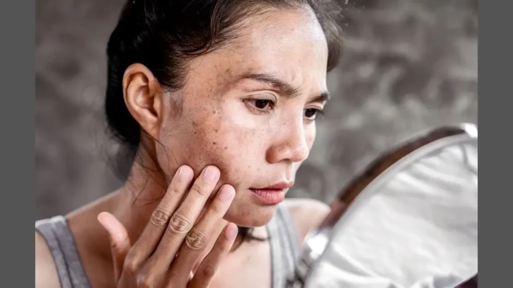 महिला अपने चेहरे पर dark spots और pigmentation देखते हुए – घरेलू उपाय से साफ और चमकदार त्वचा के लिए
