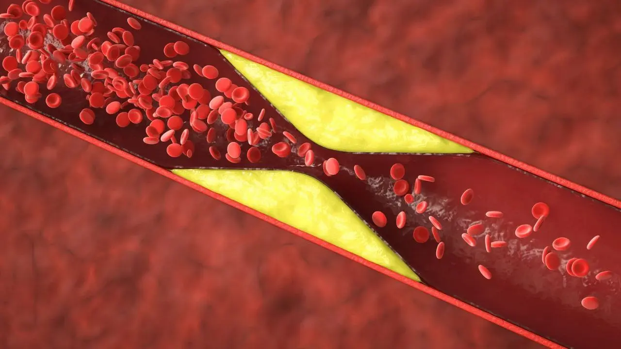 Platelet Increase Food: प्लेटलेट्स की कमी को दूर करने वाले 10 असरदार सुपरफूड्स
