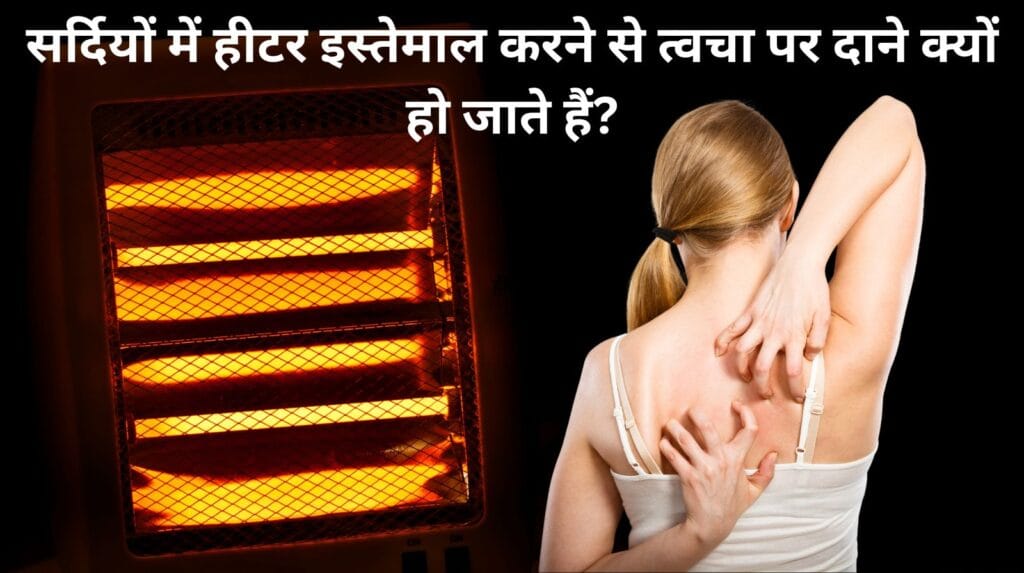 सर्दियों में हीटर की गर्म हवा से पीठ पर खुजली और दाने वाली त्वचा वाली महिला