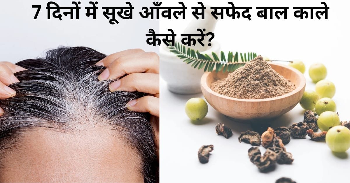 7 दिनों में सूखे आँवले से safed baal काले करें – natural shine हेयर के 5 उपाय